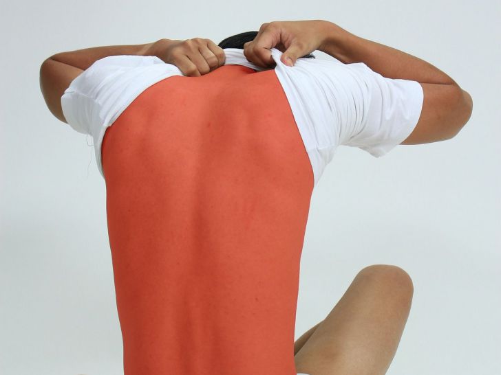 Aumentan de forma alarmante los casos de sarna en España: Se multiplican por 50 en 12 años