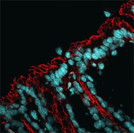 Identifican un mecanismo celular que afecta la microbiota intestinal y aumenta el riesgo de enfermedades