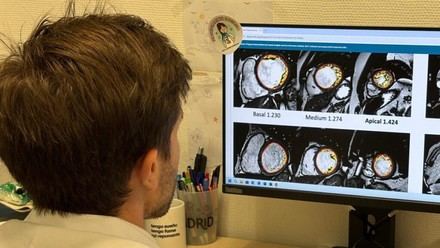 El Hospital Puerta de Hierro descarta una enfermedad cardíaca tras un estudio genético y de resonancia