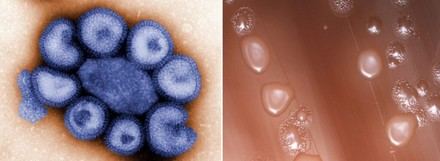 El orden de infección influye en la respuesta del sistema inmunitario y la evolución de enfermedades