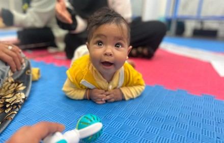 Fisioterapia: clave para la recuperación de niños desnutridos en Yemen
