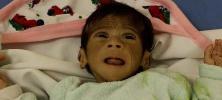 La OMS advierte sobre una grave crisis de hambre en Gaza