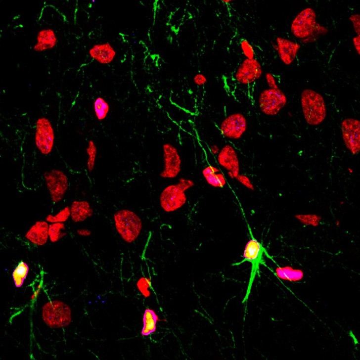 El consumo de alcohol y drogas, junto a enfermedades psiquiátricas, afecta la generación de nuevas neuronas en el cerebro