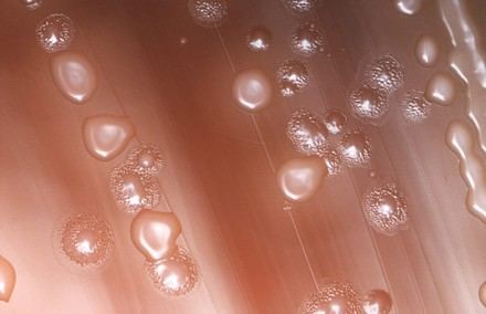 Las vacunas contra el neumococo disminuyen infecciones resistentes en niños