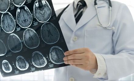 Microinfartos cerebrales: claves para su detección y prevención