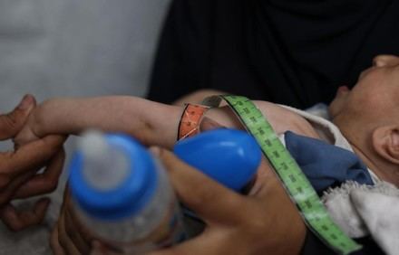 Crisis humanitaria en Gaza: el hambre afecta a población y trabajadores de ayuda