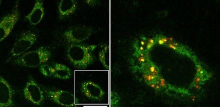 Un estudio revela que los nanoplásticos podrían afectar la función tiroidea y representar un riesgo para la salud