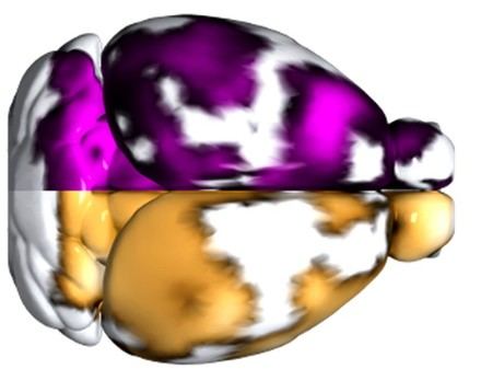 Detectan microtrombos en el cerebro de pacientes con alzhéimer mediante una nueva técnica de imagen no invasiva