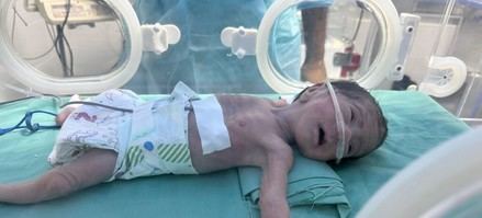UNRWA denuncia que la hambruna en Gaza es intencionada y creada
