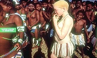 Ser albino en Tanzania puede costarte la vida